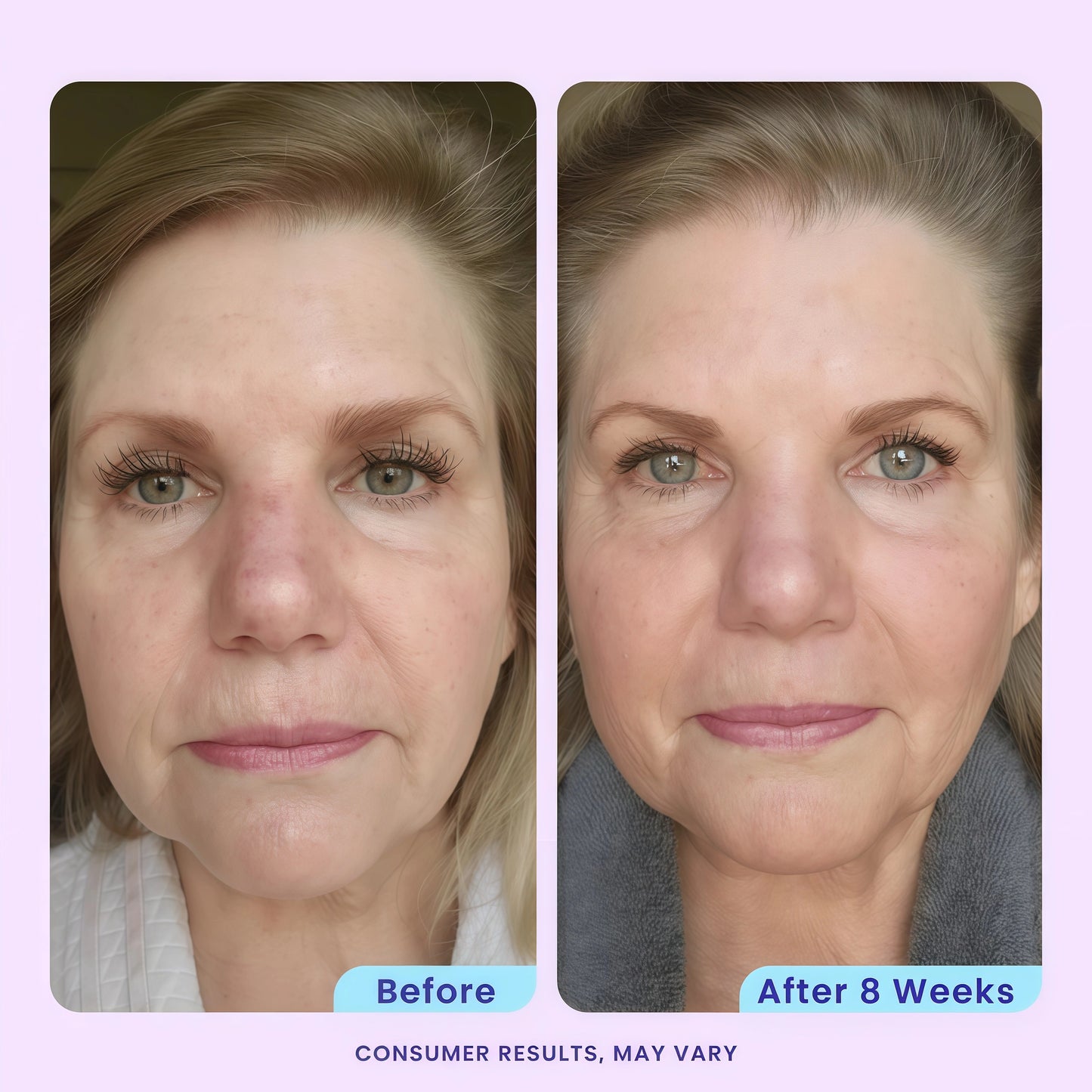GOPURE Fine Line Fix Duo - Eye Gel + Anti Wrinkle Moisturizer