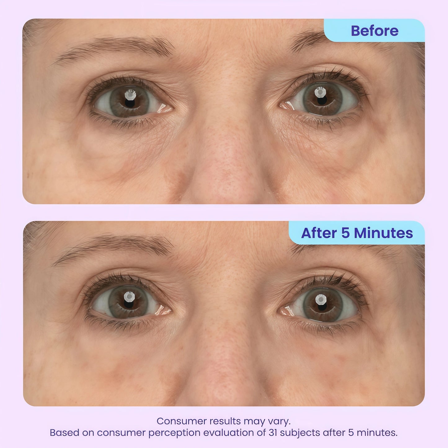 goPure NEW Instant Lift Eye Gel - For the look of Puffiness & Bags, Wrinkles, Fine Lines and Dark Circles, Anti Aging Skin Care for Men & Women with MaxLift3 Biotech Under Eye Brightener