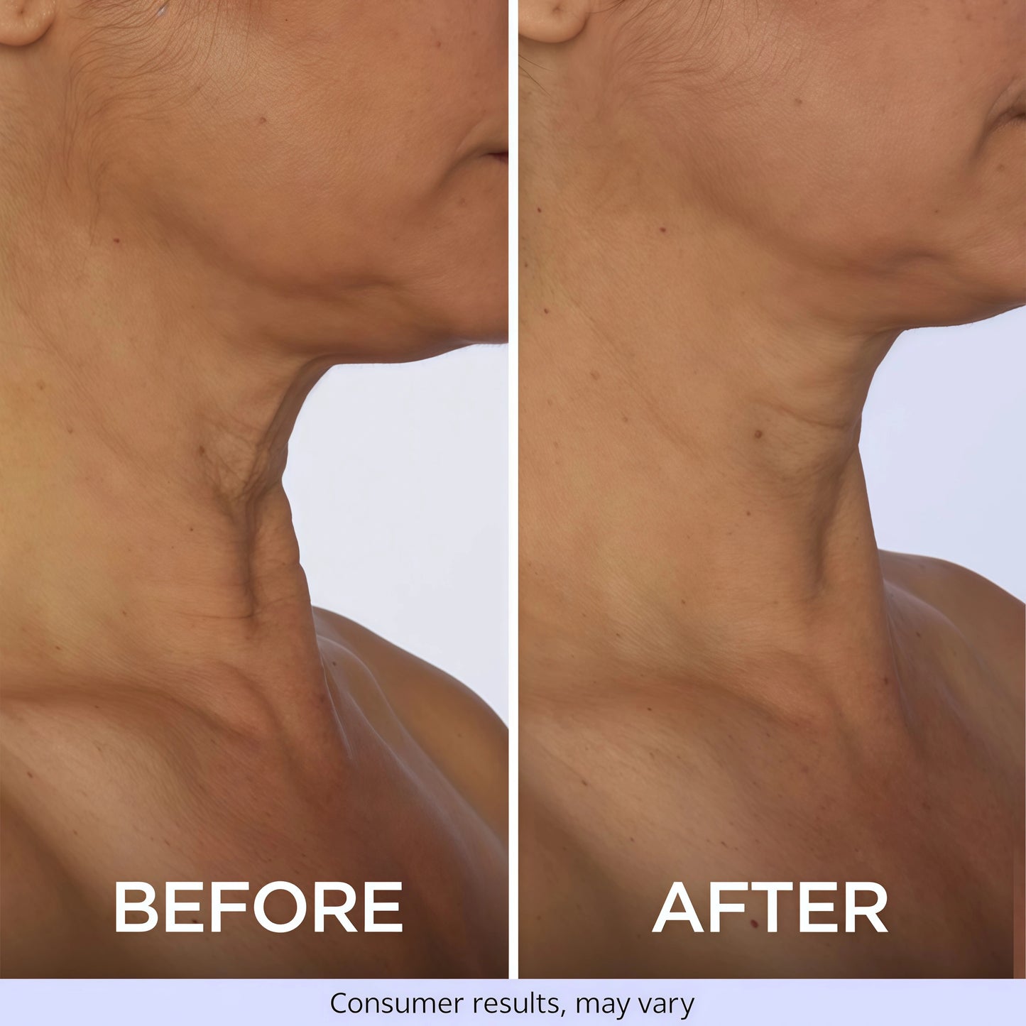 goPure Tighten & Lift Neck & Chest Moisturizer Cream for Visibly Firming, Tightening and Lifting the Look of Wrinkles & Crepey Skin, 1.7oz