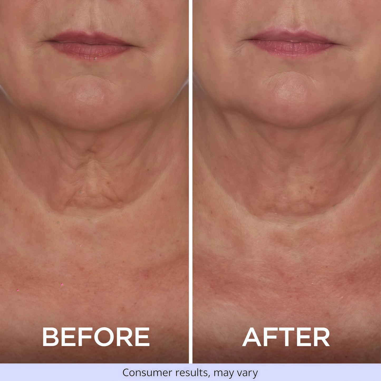 goPure Tighten & Lift Neck & Chest Moisturizer Cream for Visibly Firming, Tightening and Lifting the Look of Wrinkles & Crepey Skin, 1.7oz