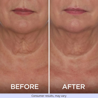 goPure Tighten & Lift Neck & Chest Moisturizer Cream for Visibly Firming, Tightening and Lifting the Look of Wrinkles & Crepey Skin, 1.7oz